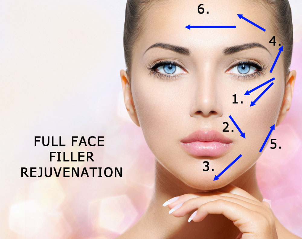 Facial Fillers For Full Face Rejuvenation 