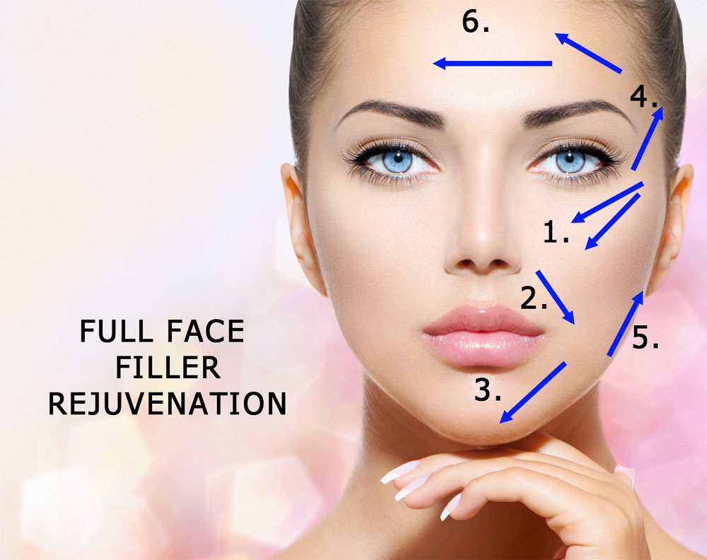 FACIAL FILLERS FOR FULL FACE REJUVENATION