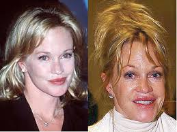 Melanie Griffith Browlift Melanie Griffith Browlift