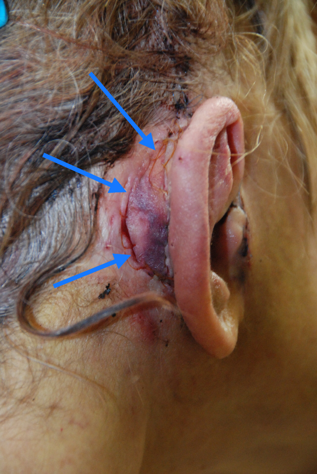 with ears back gallery how to cover ears hairstylegalleries with ears back gallery how to cover ears hairstylegalleries