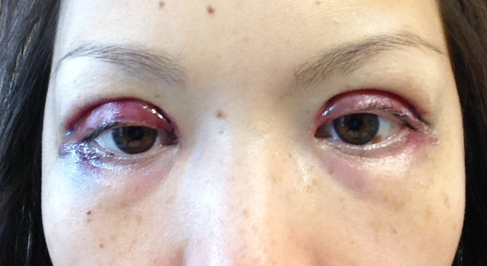 Luella recommends best of Asian double eye lid Hauer recommends Deep penetration story