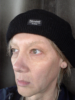 transgender surgery photos transgender surgery photos