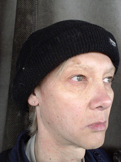 transgender surgery photos transgender surgery photos
