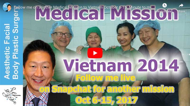 Follow me on another Medical Mission to Vietnam October 6-15. Minute to minute updates on Snapchat

