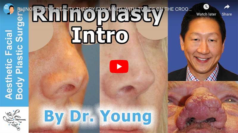 Rhinoplasty Seattle WA - Nose Surgery - Nose Job Bellevue