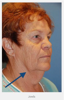 Share your photo facial treatment seattle are Sorry, photo facial treatment seattle